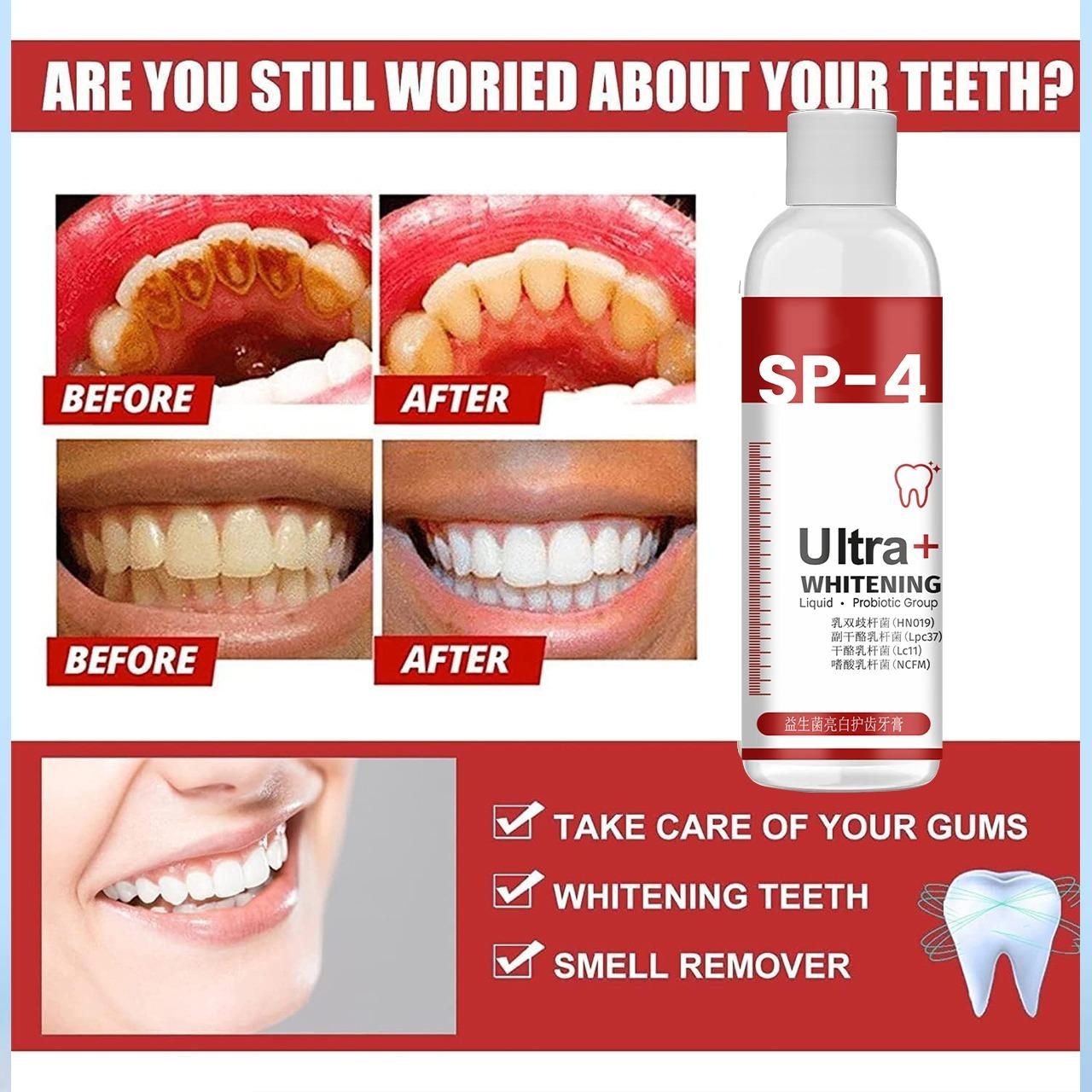 New SP-4 Ultra+ Whitening Teeth (Pack of 1) 🦷✅